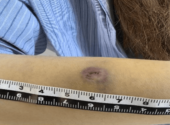 杭州警方通报：4名伤者均为女性