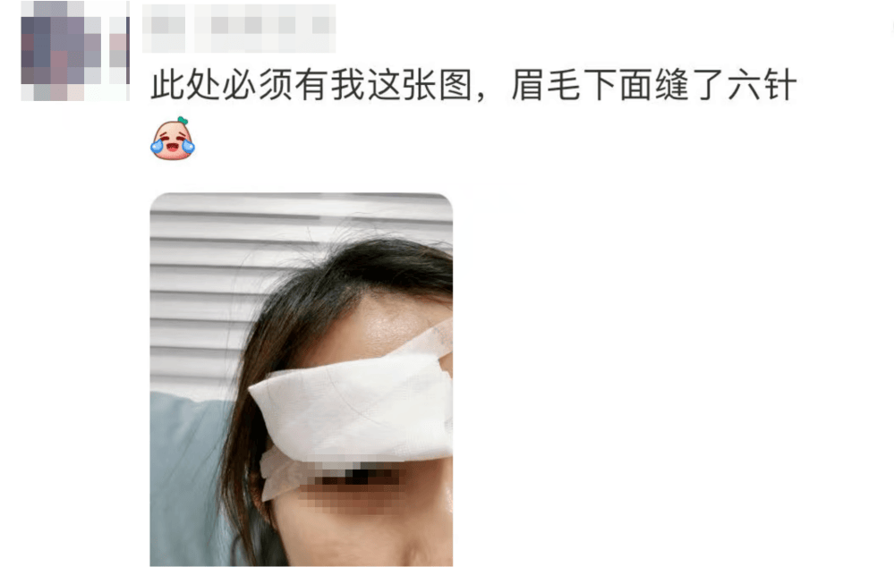 “杀伤力”惊人！击穿眉骨、扎穿手指……有明星也曾中招！很多深圳人也爱玩