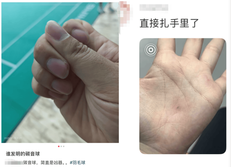 “杀伤力”惊人！击穿眉骨、扎穿手指……有明星也曾中招！很多深圳人也爱玩