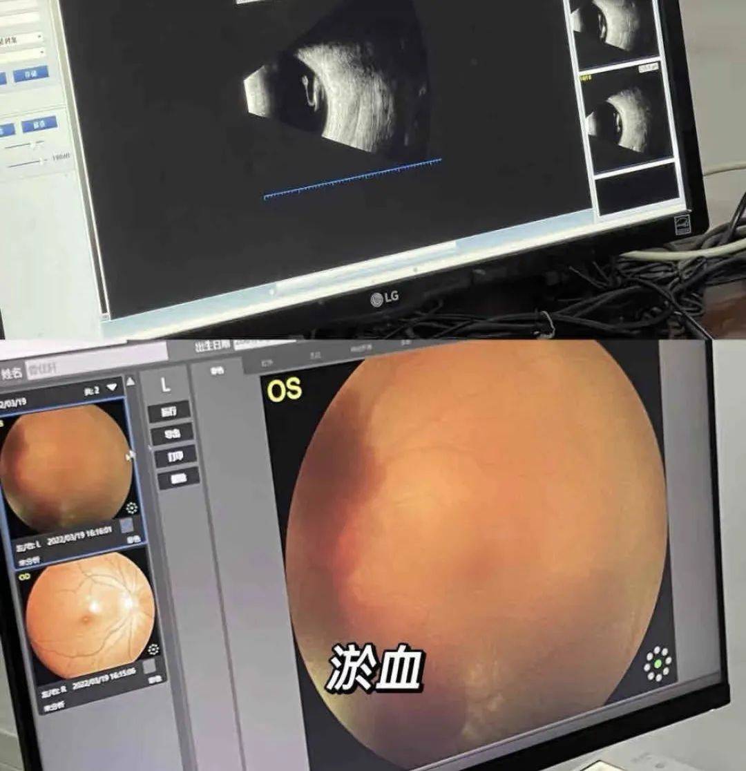 “杀伤力”惊人！击穿眉骨、扎穿手指……有明星也曾中招！很多深圳人也爱玩