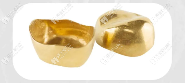 贵金属全瓷牙(贵金属全瓷牙的优缺点)