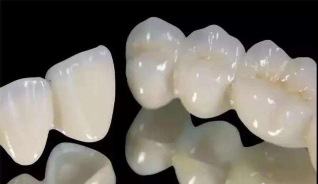 贵金属烤瓷(贵金属烤瓷牙是什么材质)
