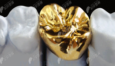 贵金属牙冠(贵金属牙冠能做核磁吗)